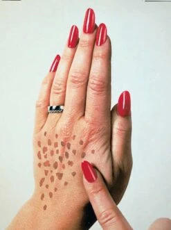 Altersflecken-Creme - Transparent